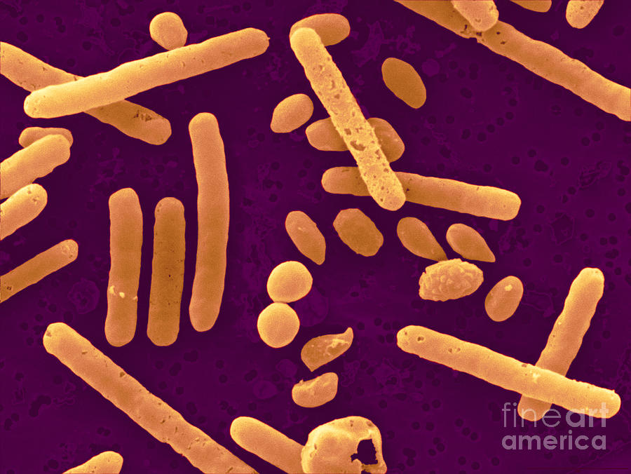 Clostridium Difficile Bacteria #2 Photograph by Scimat