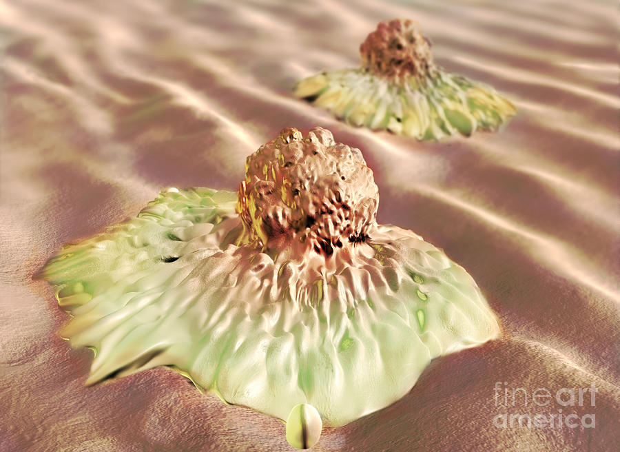 Cancer Photograph - Colon Cancer Cells, Illustration #2 by Spencer Sutton