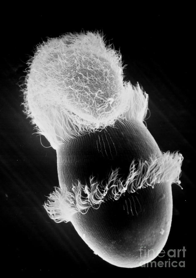 Didinium Attacking Paramecium SEM #2 Photograph by Greg Antipa