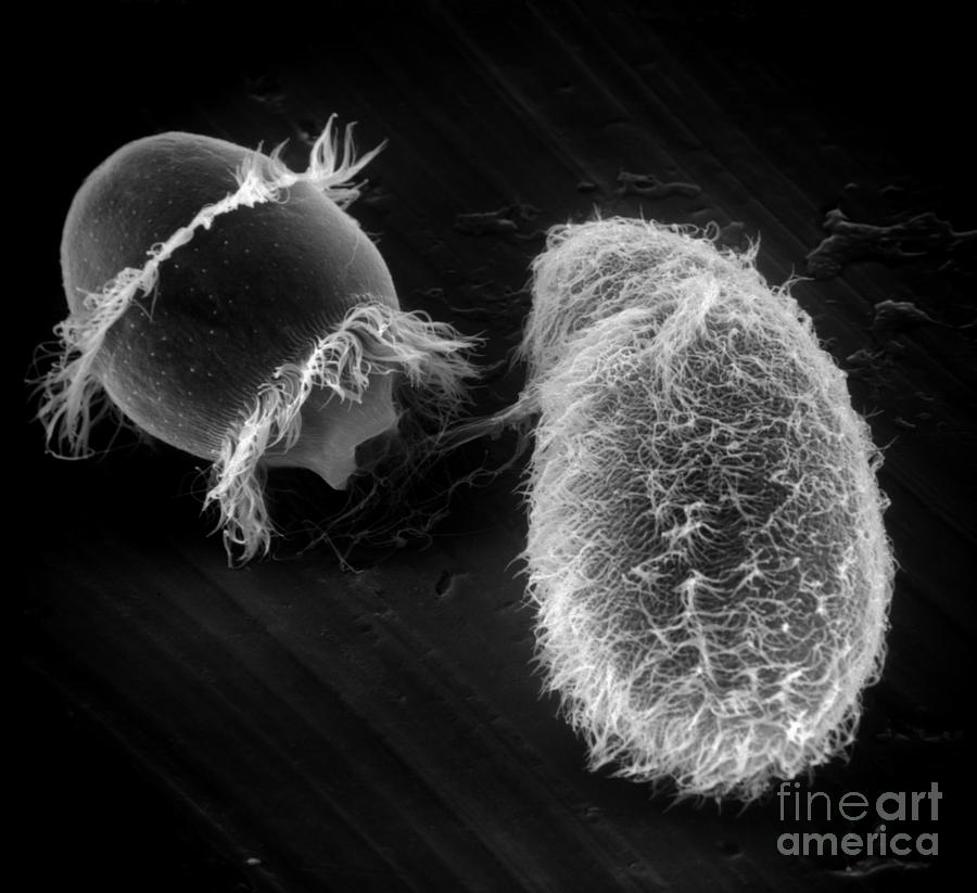 Didinium Ingesting Paramecium, Sem #2 Photograph by Greg Antipa
