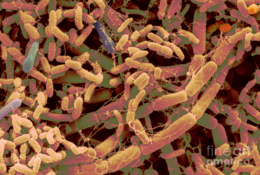Food Spoilage Bacteria #2 Photograph by Scimat