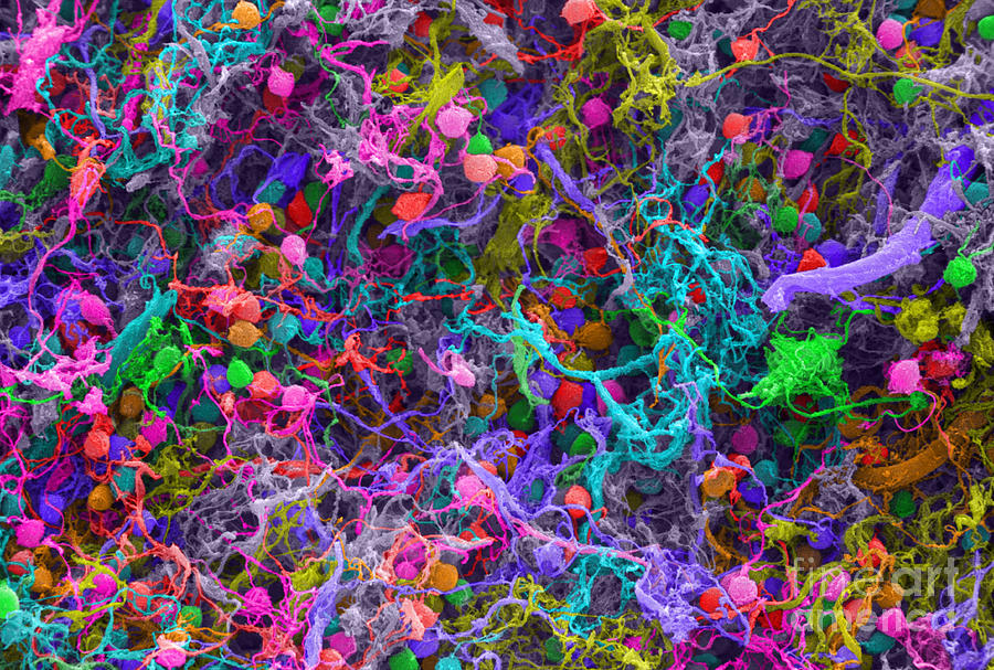 Human Brain Cells, Sem #5 Photograph by Ted Kinsman