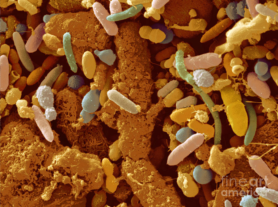 Human Feces Containing Bacteria #2 Photograph by Scimat