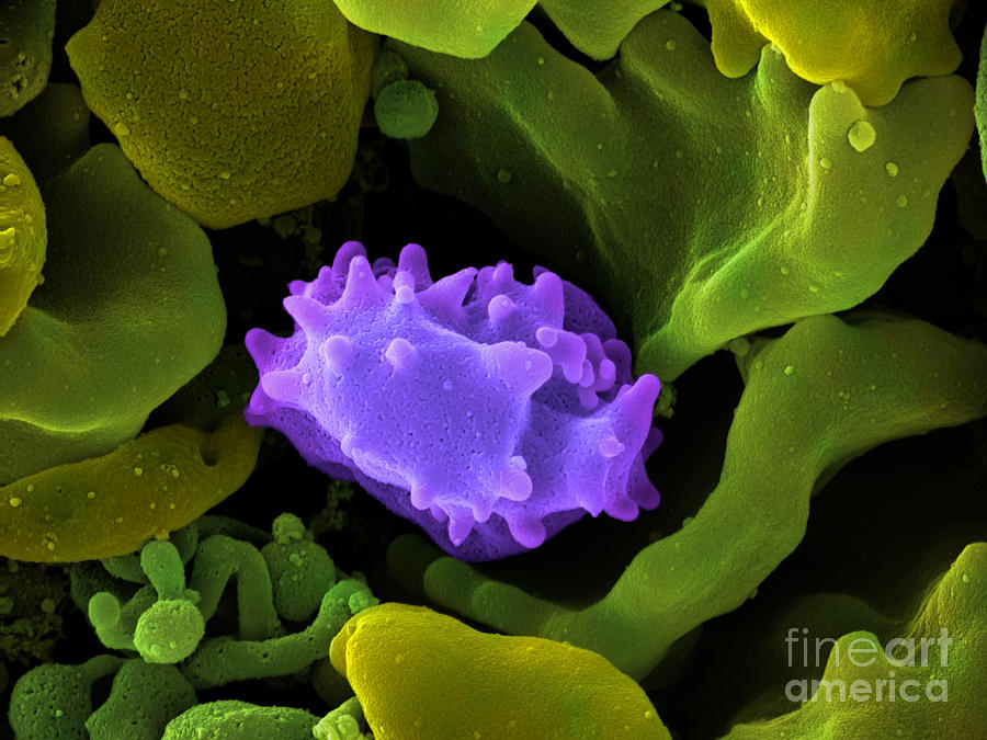 Human Lymphocyte Cell, Sem #2 Photograph by Ted Kinsman