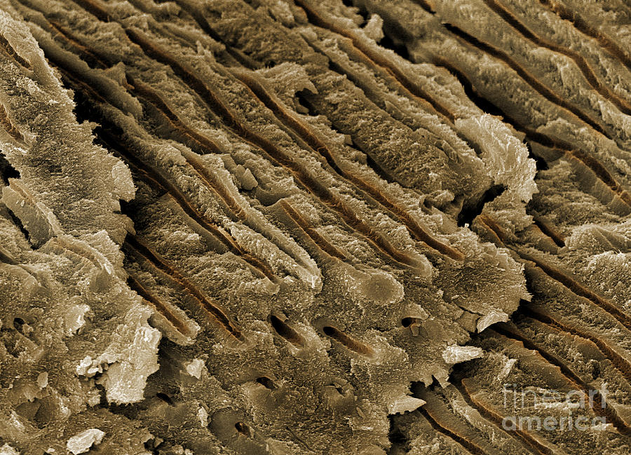 Human Tooth Dentine, Sem #2 Photograph by Ted Kinsman