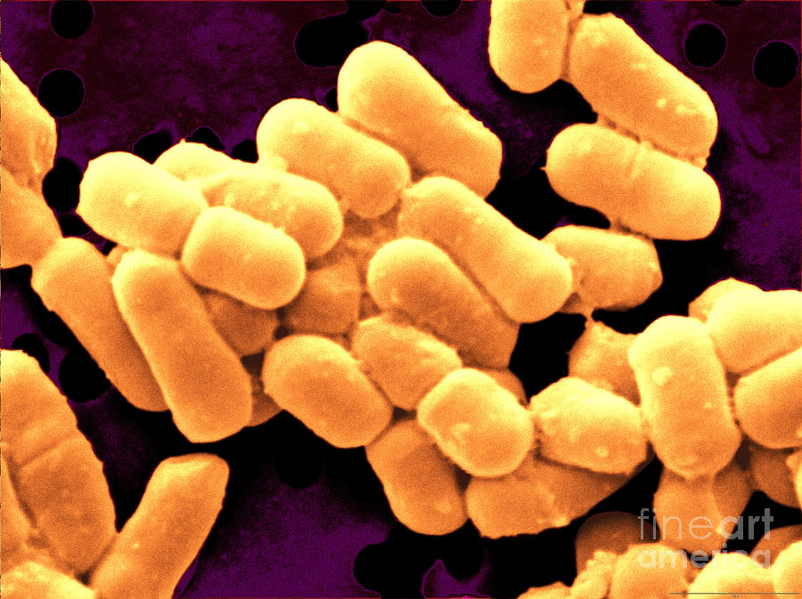 Lactobacillus Fermentum #2 Photograph by Scimat