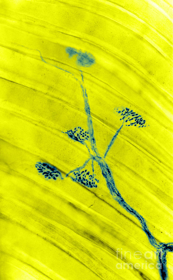 Neurone Photograph - Motor End Plates, Lm #2 by Biophoto Associates