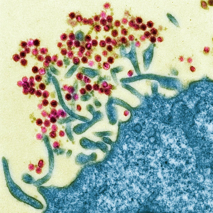 White Blood Cell Photograph - Mouse Leukaemia Viruses, Tem #2 by Steve Gschmeissner