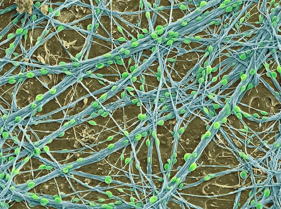 Nerve Cell Photograph - Nerve Cells, Sem #2 by Thomas Deerinck, Ncmir