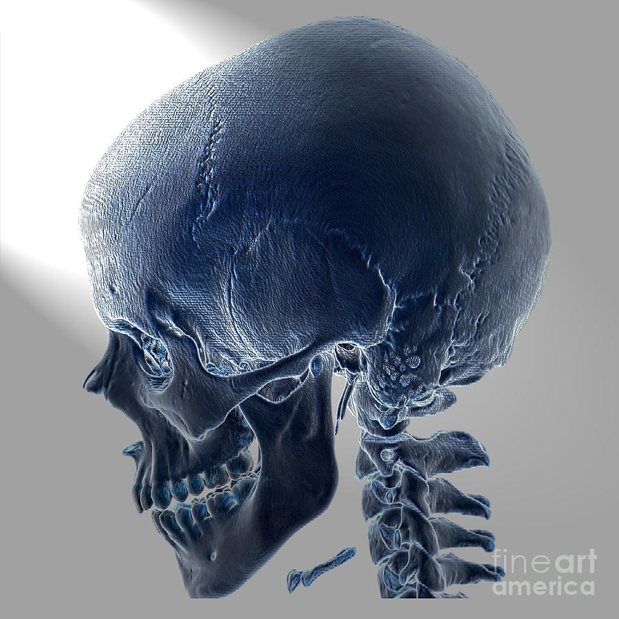 Normal Skull, 3d Ct Scan #2 Photograph by Living Art Enterprises