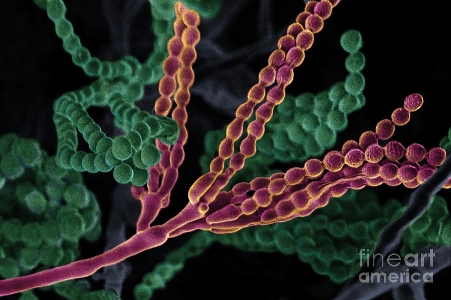Penicillium With Spores #2 Photograph by Scimat