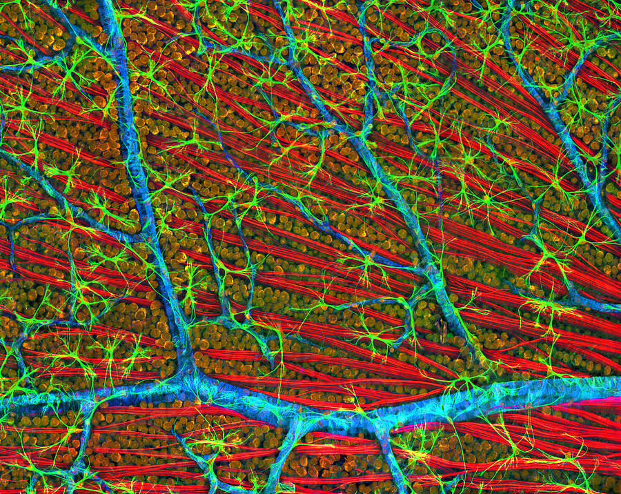 Retina Blood Vessels And Nerve Cells #2 by Thomas Deerinck, Ncmir