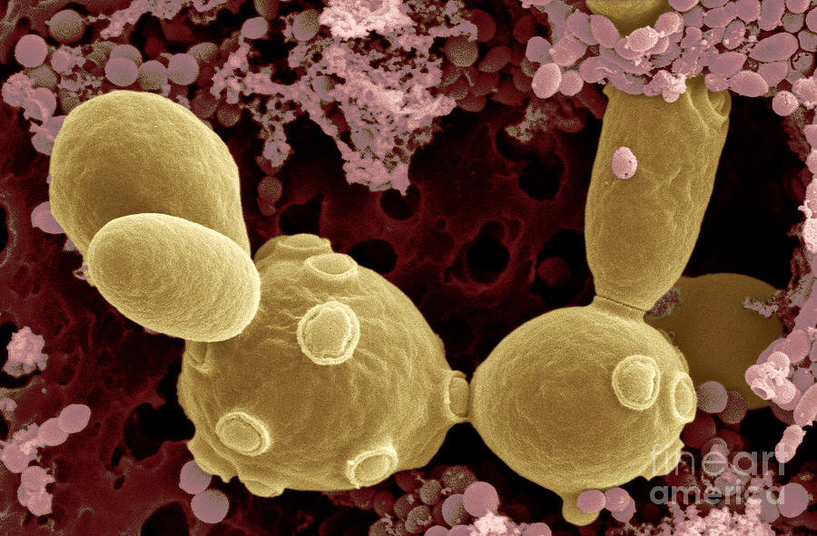 saccharomyces cerevisiae electron microscope