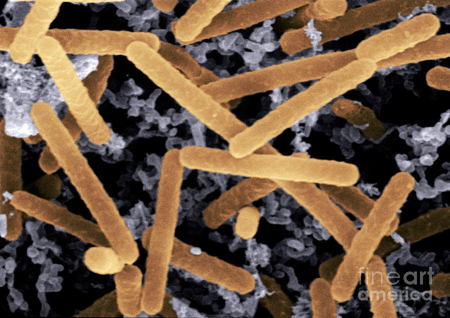 Sem Of Lactobacillus Acidophilus #2 Photograph by Scimat