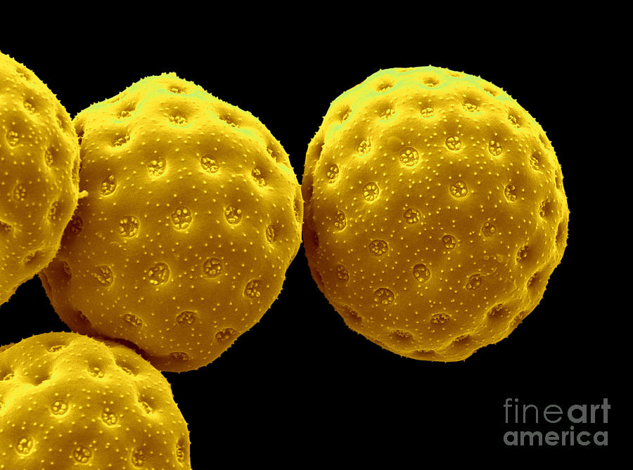 Sem Of Orache Pollen #2 Photograph by Scimat