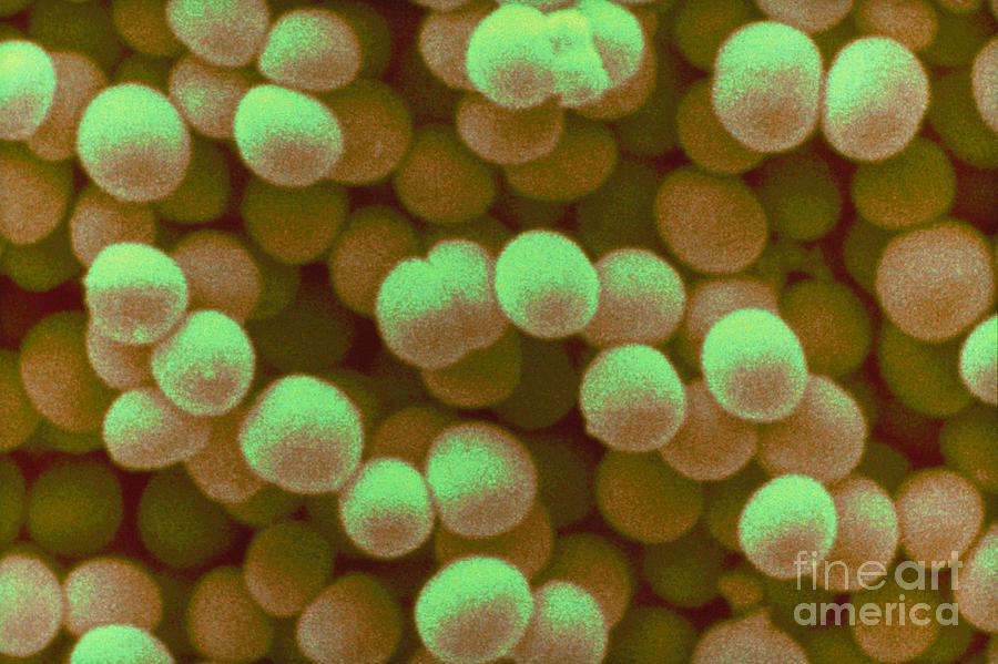 Staphylococcus Aureus #2 Photograph by Scimat