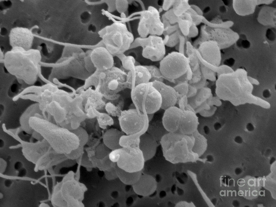 Staphylococcus Epidermidis Bacteria #2 Photograph by Scimat