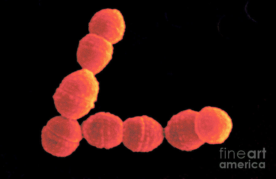 Streptococcus Cremoris #2 Photograph by Scimat