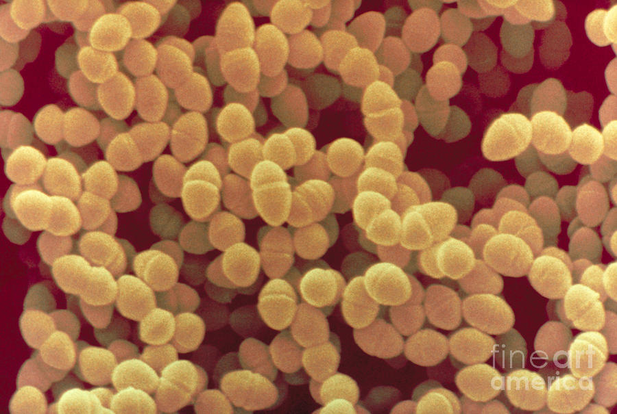 Streptococcus Faecium #2 Photograph by Scimat