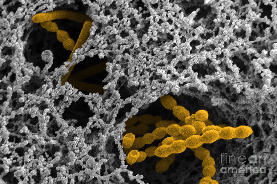 Streptococcus Thermophilus #2 Photograph by Scimat