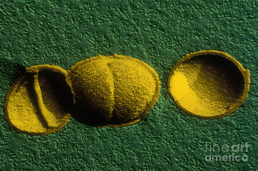 Streptococcus Thermophilus, Tem Photograph by Scimat | Fine Art America