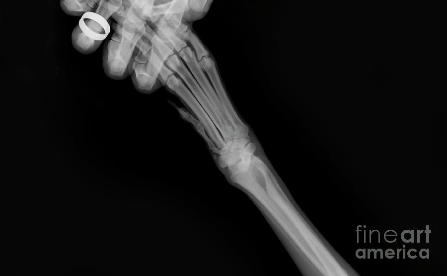 Xray of a dog's front left leg Photograph by Yael Rosen Pixels