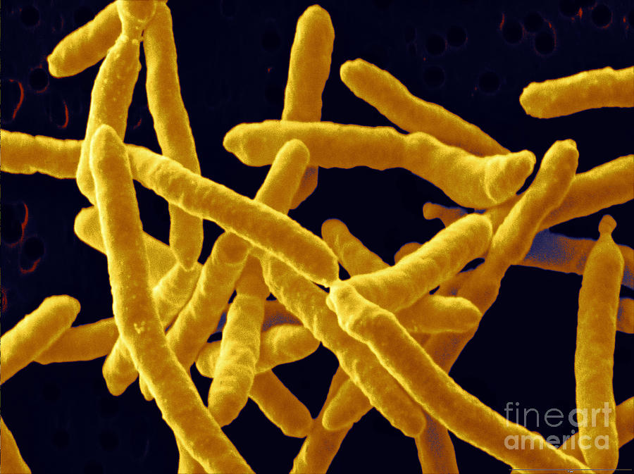 Yersinia Enterocolitica Bacteria #2 Photograph by Scimat