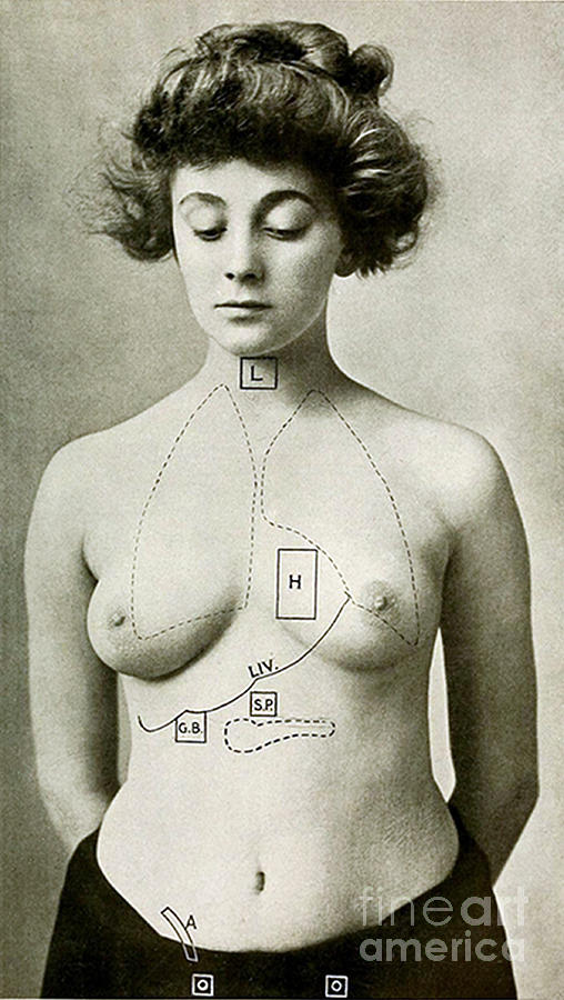 Electro-therapeutics, 1910 #20 Photograph by Science Source