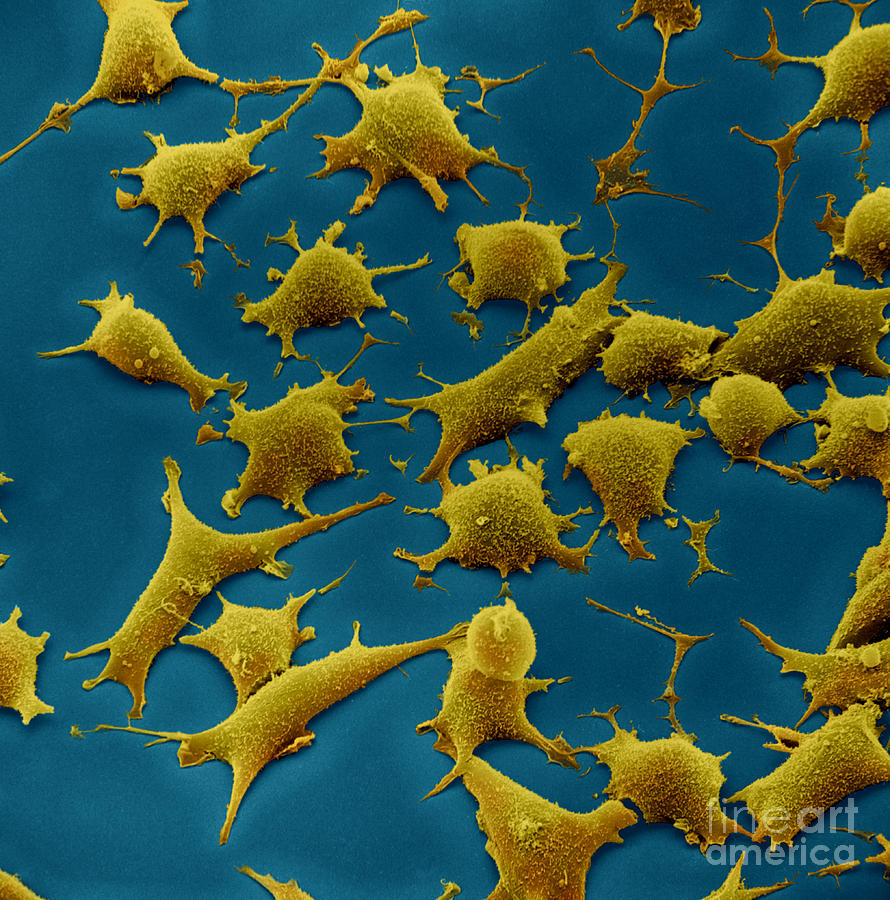 Human Fibroblast Cells #26 Photograph by David M. Phillips