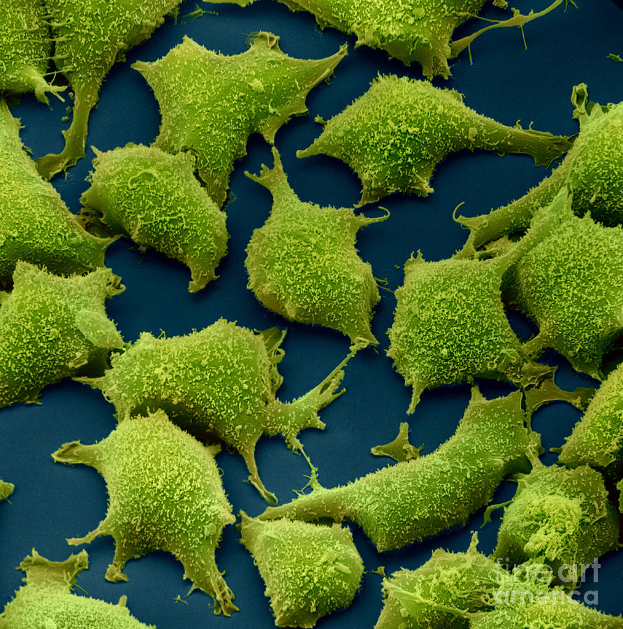 Human Fibroblast Cells #28 Photograph by David M Phillips
