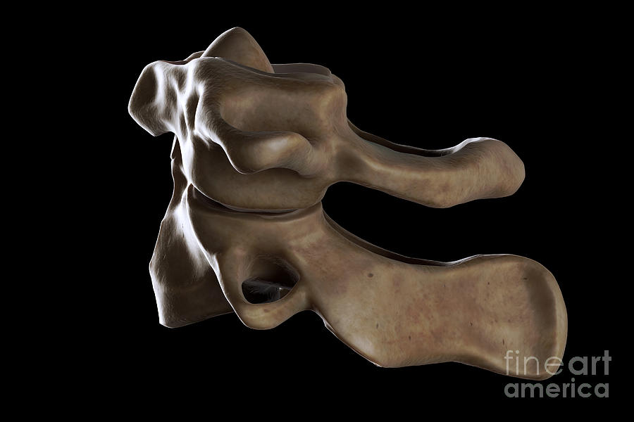 Atlas And Axis Vertebrae #3 Photograph by Science Picture Co