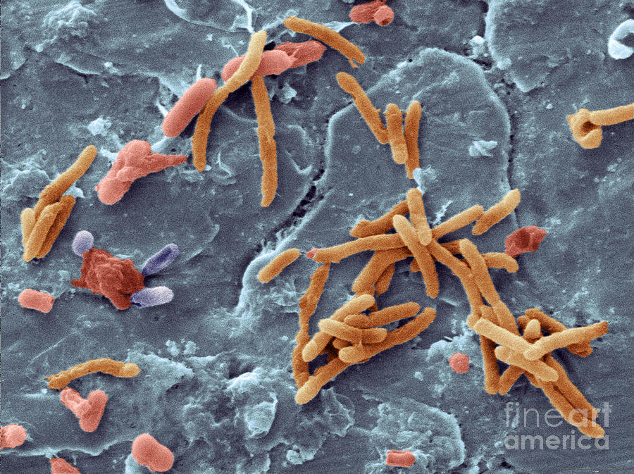 Bacteria From Raw Chicken Meat, Sem #3 Photograph by Scimat