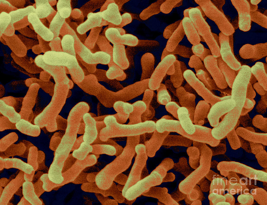 Bifidobacterium Pullorum #3 Photograph by Scimat
