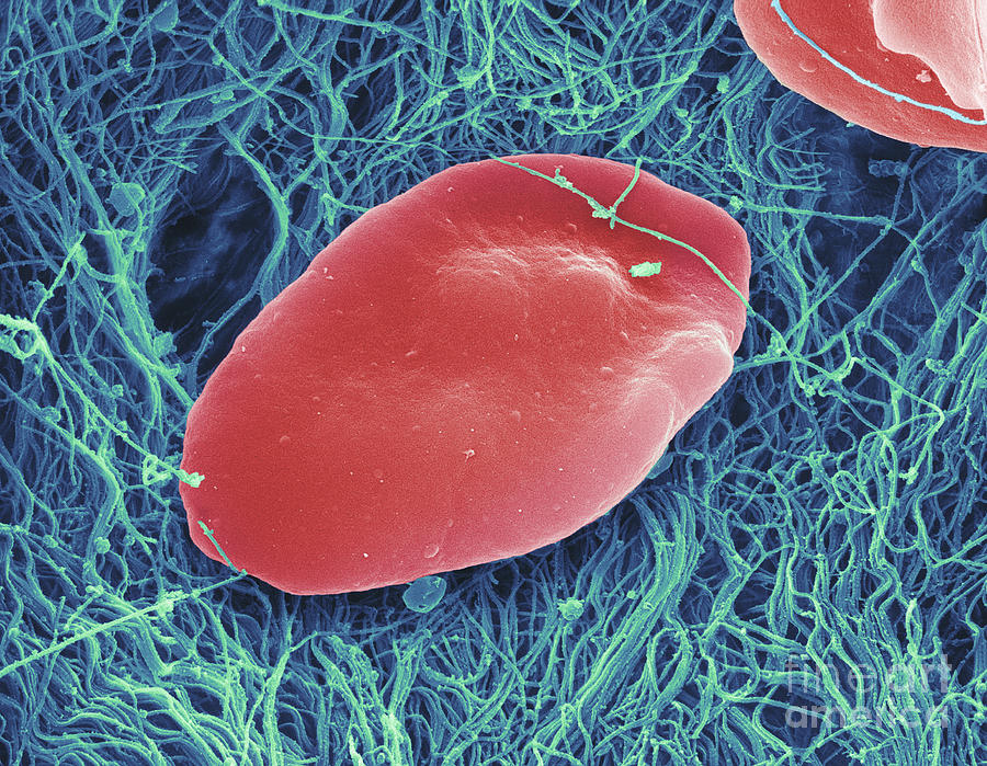 Blood Platelets, Sem #3 Photograph by Ted Kinsman