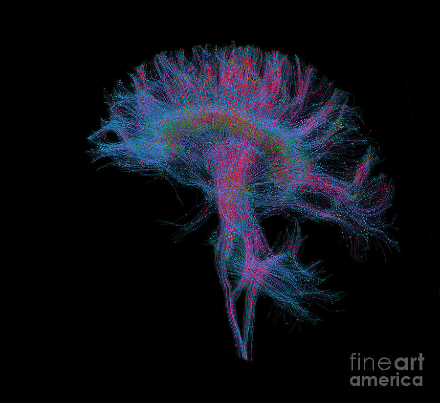 Brain, Fiber Tractography Image #3 Photograph by Scott Camazine