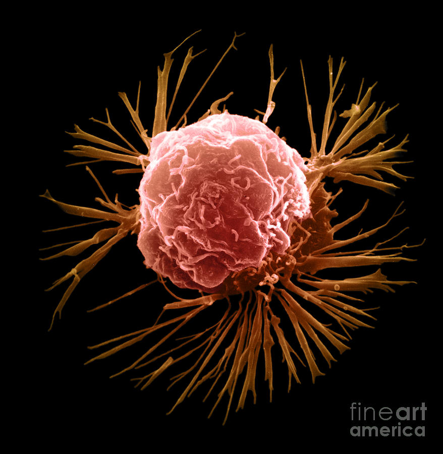 Breast Cancer Cell Photograph by Science Source