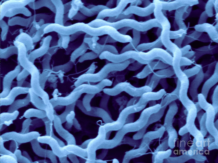 Campylobacter Jejuni Photograph by Scimat