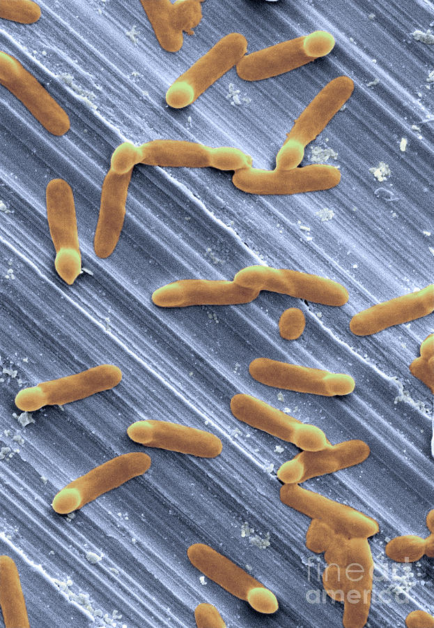 Clostridium Difficile Bacteria #3 Photograph by Scimat