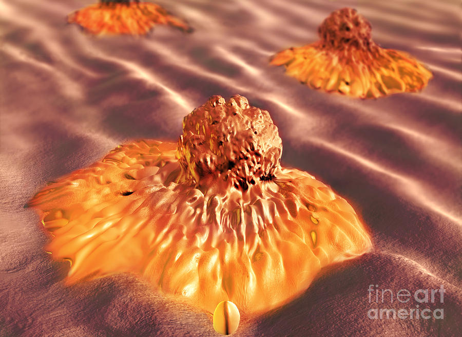 Cancer Photograph - Colon Cancer Cells, Illustration #3 by Spencer Sutton