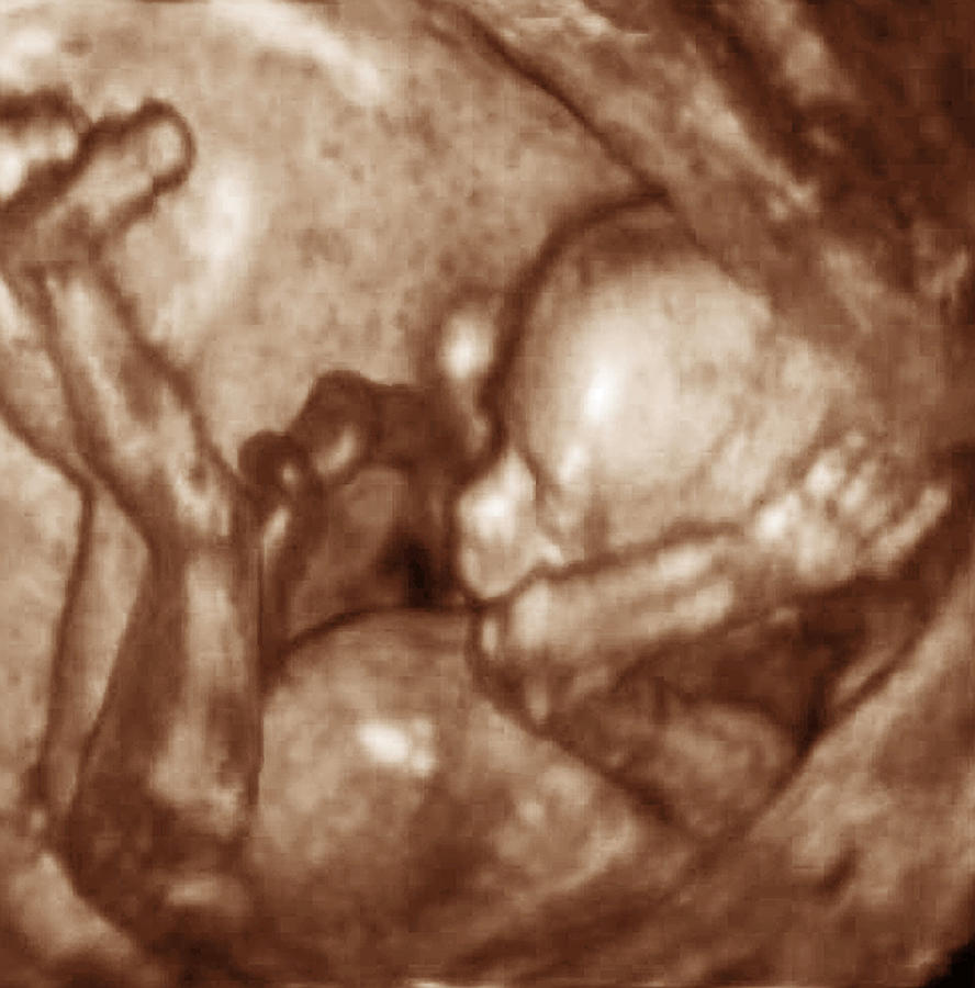 Reproductive Physiology Photograph - 3-d Foetal Ultrasound by Ge Medical Systems