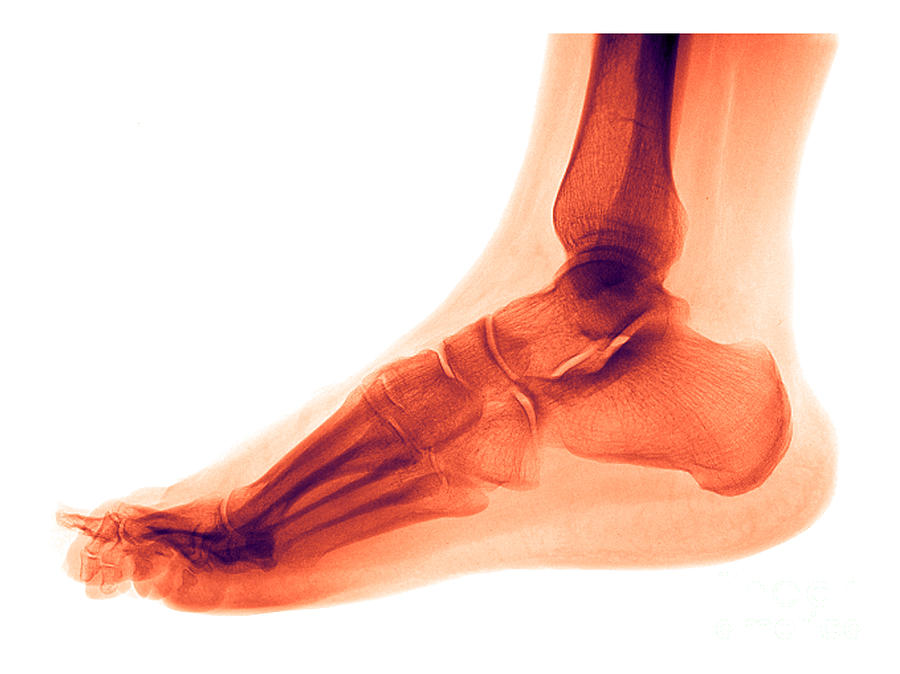 Skeleton Photograph - Foot #3 by Medical Body Scans