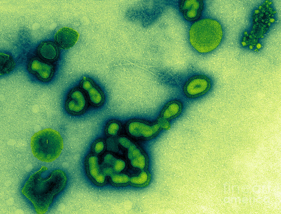 H1n1, Influenza A, Russian Flu, Tem #3 Photograph by Science Source