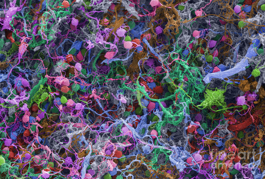 Human Brain Cells, Sem #3 Photograph by Ted Kinsman