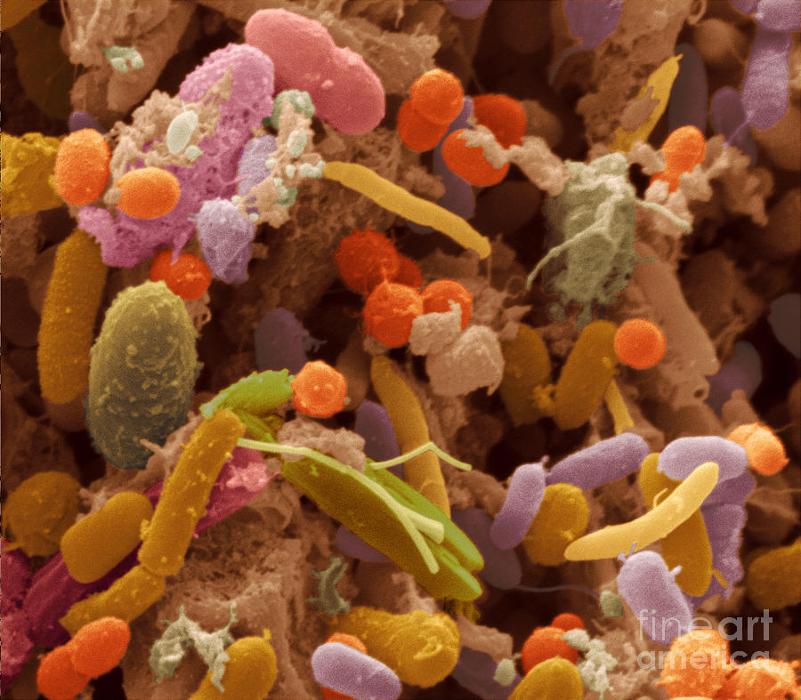 Human Feces Containing Bacteria #3 Photograph by Scimat
