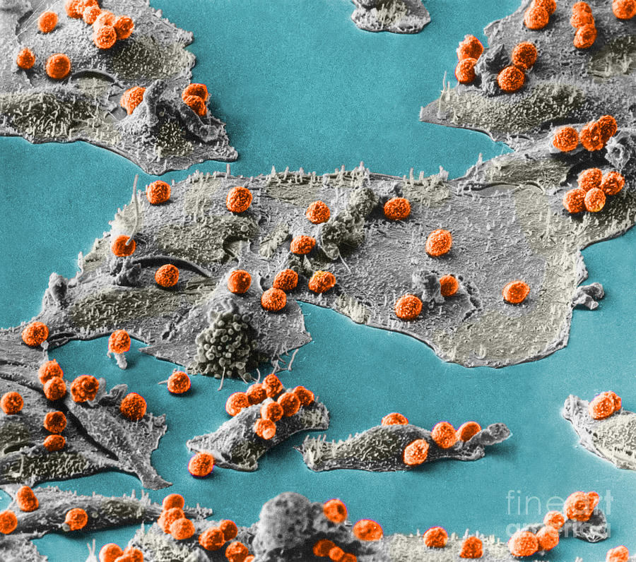 Immune Cells Attacking Cancer Cells, Sem #5 Photograph by Science Source