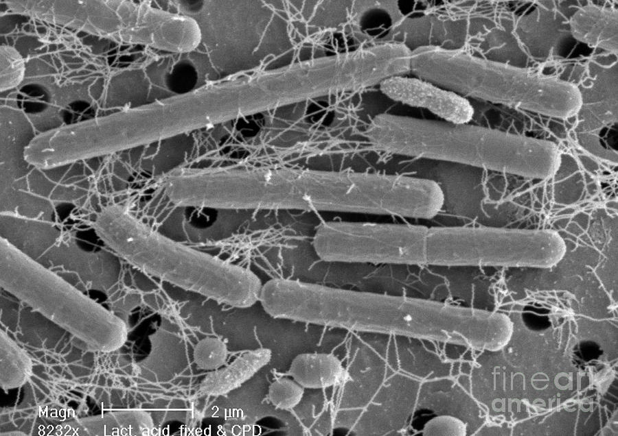 Lactobacillus Acidophilus Photograph by Scimat