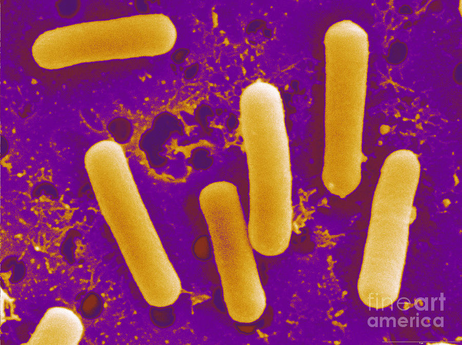 Lactobacillus Reuteri #3 Photograph by Scimat