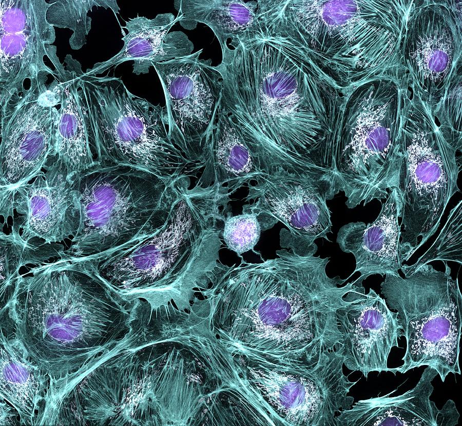 Biological Photograph - Lung Cells, Fluorescent Micrograph #3 by Dr Torsten Wittmann