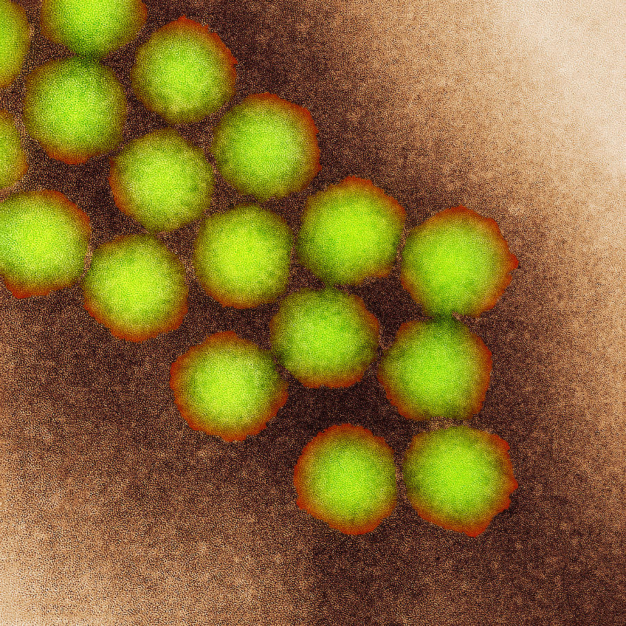 Poliovirus Photograph - Poliovirus Particles, Tem #3 by Nibsc