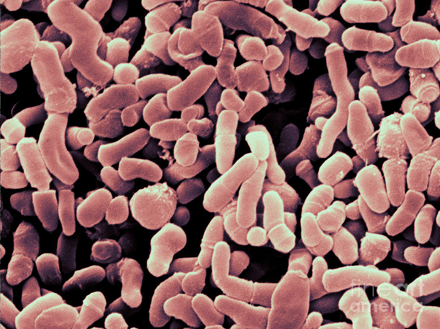 Propionibacterium Acnes Bacteria, Sem #3 Photograph by Scimat
